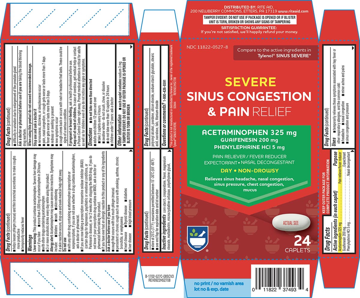 Sinus Congestion and Pain — Reference image, actual packaging may vary